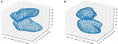 Parkinson's Disease Detection Using Isosurfaces-Based Features and Convolutional Neural Networks